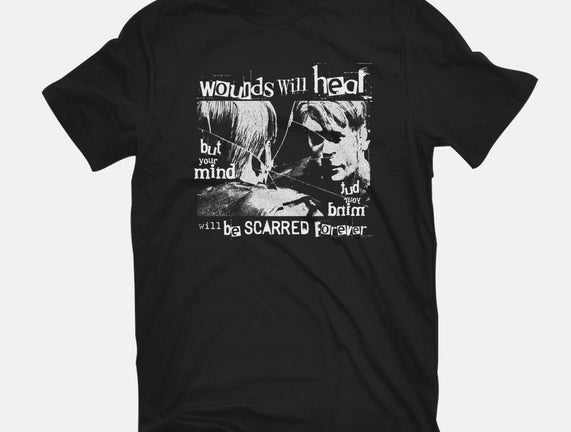 Wounds will heal