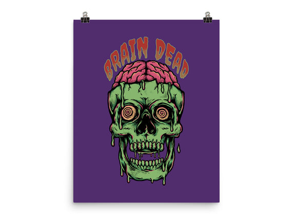 Brain Dead
