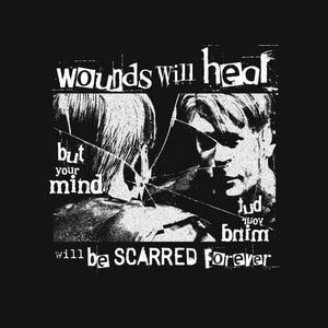 Wounds will heal