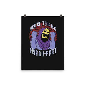 Tearing Myaaah-Part