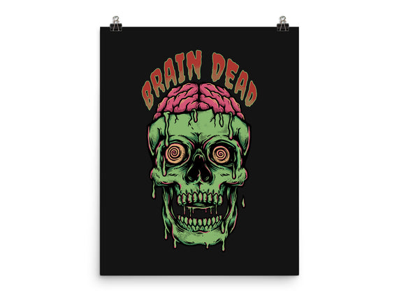 Brain Dead