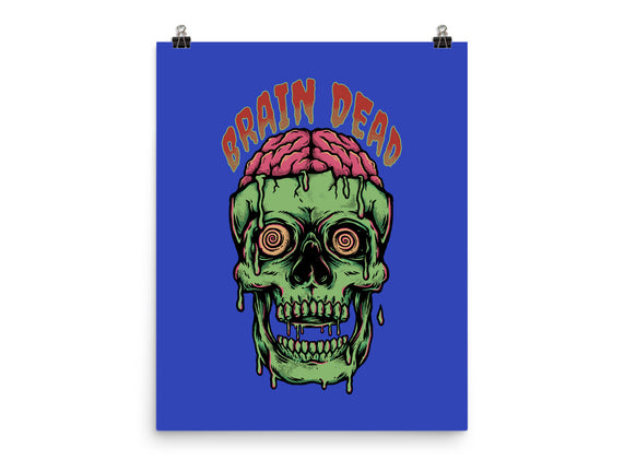 Brain Dead